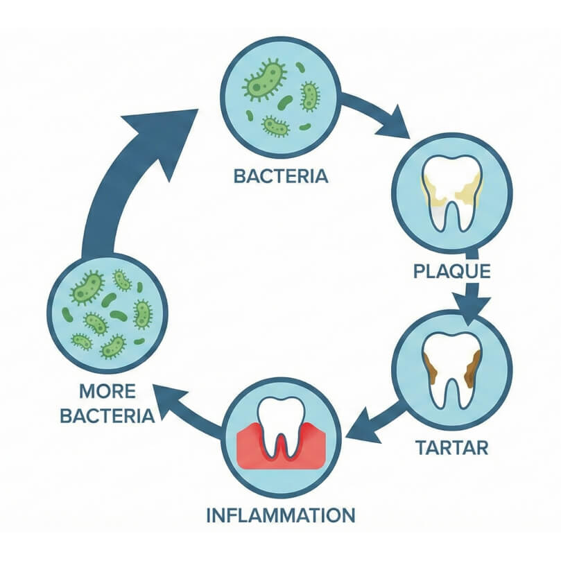 Cirkeldiagram over tandproblemer: bakterier → plak → tandsten → betændelse → øget bakterievækst